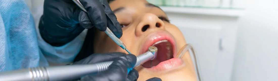 FC – Emergency Dentistry at iSmilespa, Santa Cruz, CA