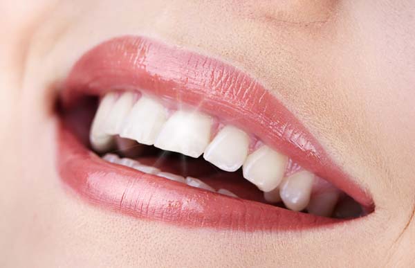 Professional Teeth Whitening Treatment From A  Cosmetic Dentist