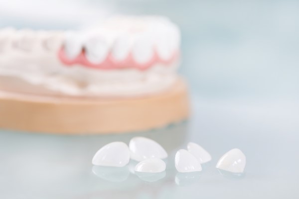 Choose Veneers To Correct Stained Teeth