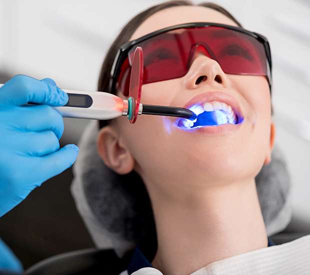 Santa Cruz Professional Teeth Whitening